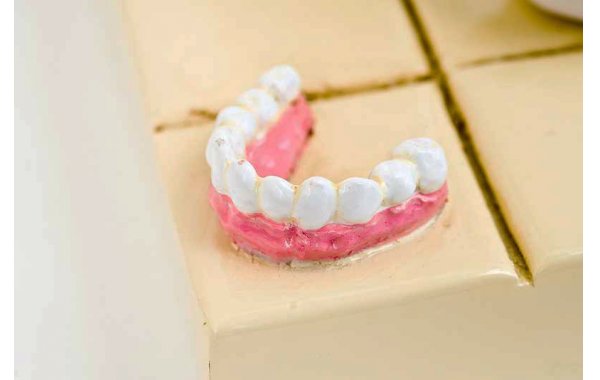 Bild 6 - Zahnarzt - the dentist